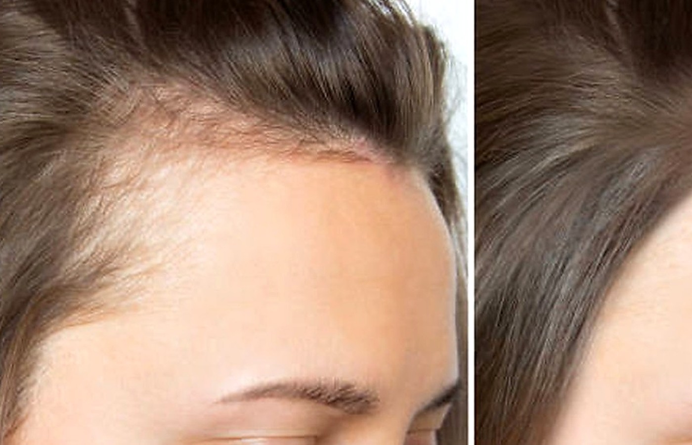Hair & Scalp wellness guide